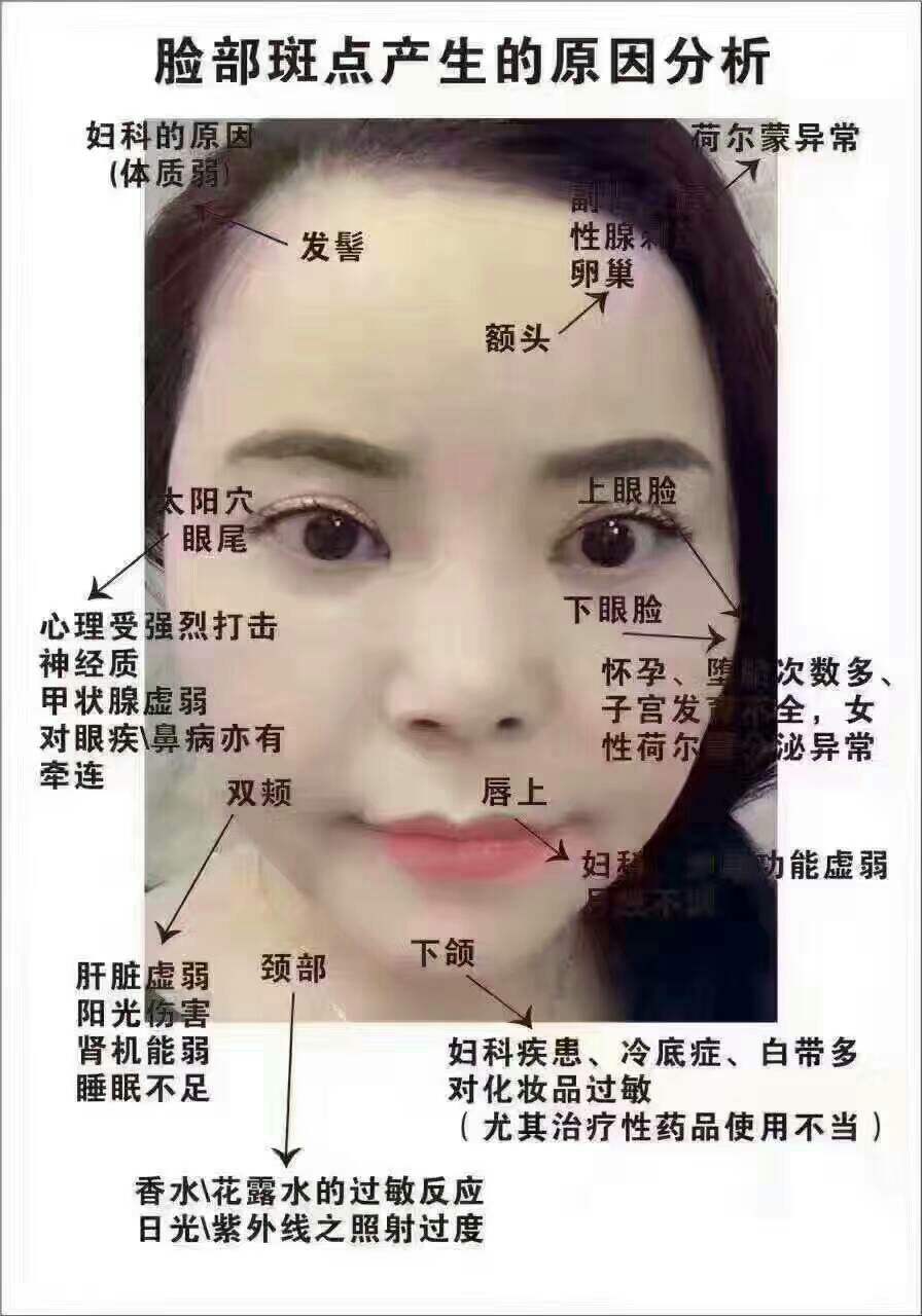 人脸上为什么长斑 脸上为什么长斑的原因